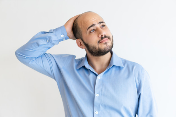 how to prevent male baldness